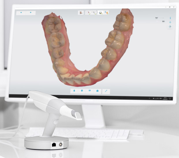 Pembroke Pines 3D Cone Beam and 3D Dental Scans