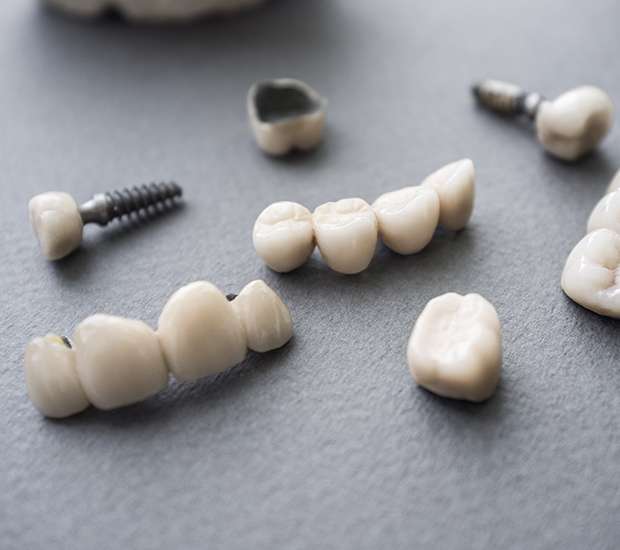 Pembroke Pines The Difference Between Dental Implants and Mini Dental Implants